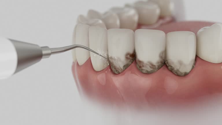 Reliable Dental contractor in Lake Clarke Shores, FL by Dentist Open Now